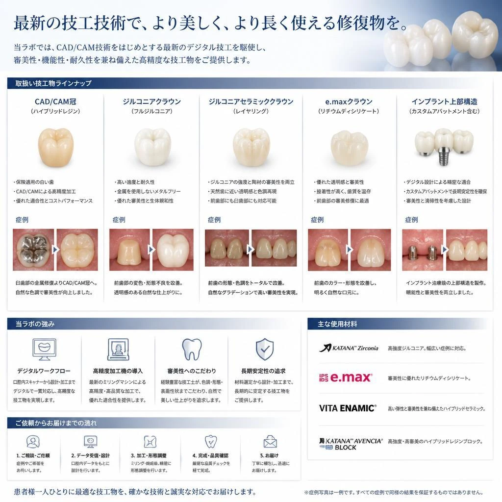 充実した技工物ラインナップ
